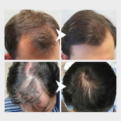 100% Natural Herbal Organic Moisturize Hair-Loss Restore